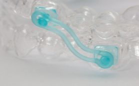 kieferorthopaedie-linge-leistungen-schnarcherschiene-detail