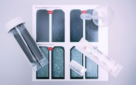 Auswertung des Speicheltests