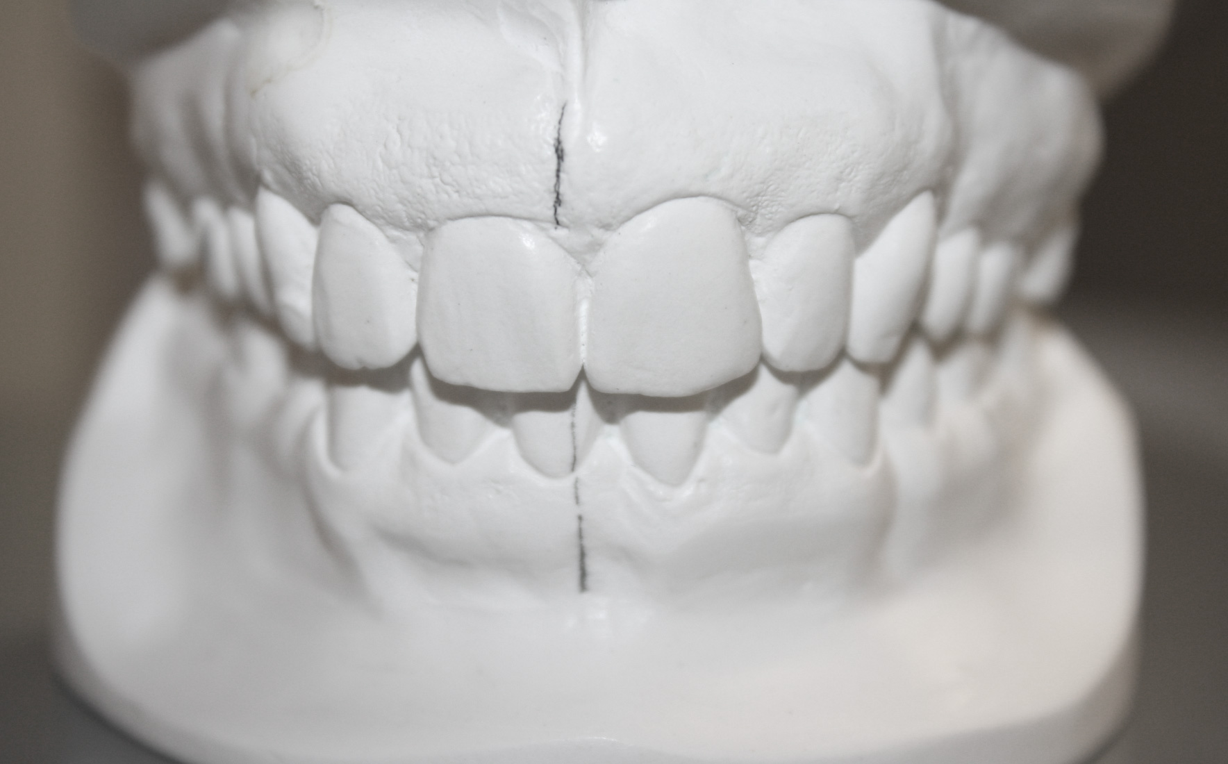 Nach der Behandlung Nach der Behandlung