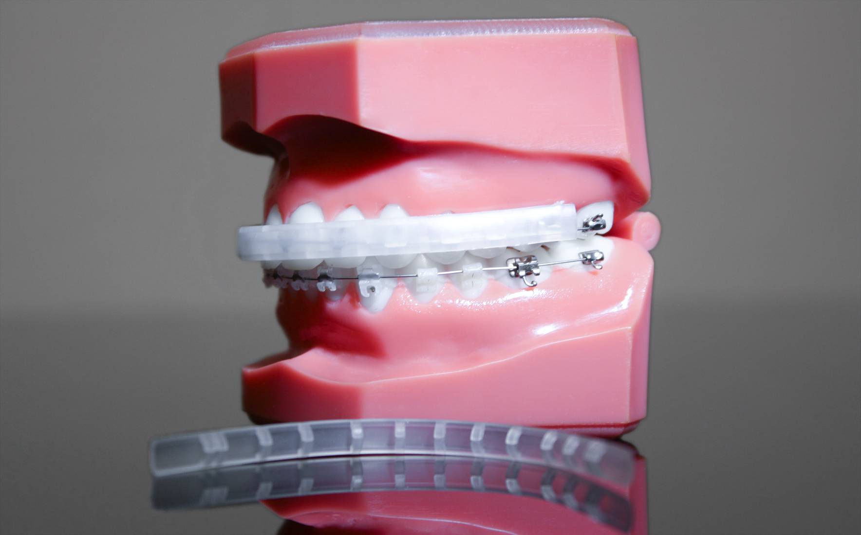 Elastischer Bracketschutz Elastischer Bracketschutz