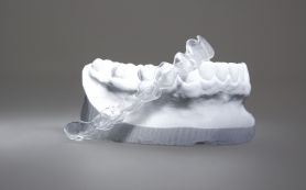 Invisalign-Schiene