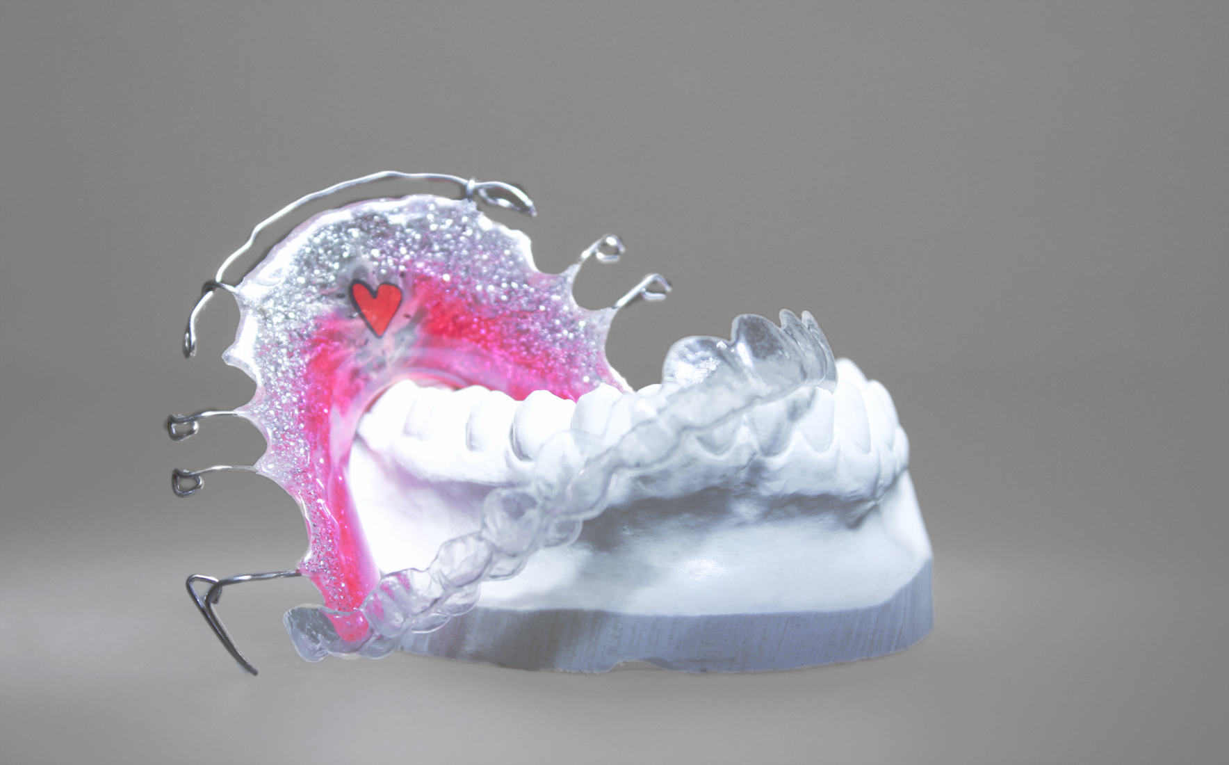 Herausnehmbare Retentionsgeräte: Plattenapparatur, Essix-Schiene Herausnehmbare Retentionsgeräte: Plattenapparatur, Essix-Schiene