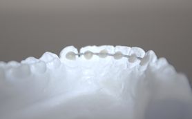 Retainer