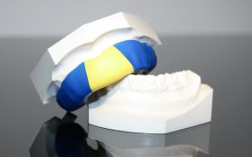 Sportmundschutz Frontzahntrauma