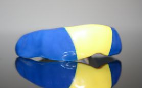 Sportmundschutz Frontzahntrauma